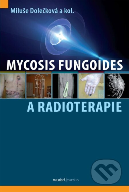 Mycosis fungoides a radioterapie - Miluše Dolečková, kol.