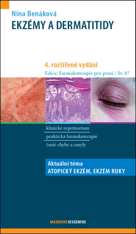Ekzémy a dermatitidy - Nina Benáková