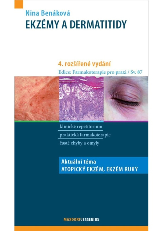 Ekzémy a dermatitidy - Nina Benáková