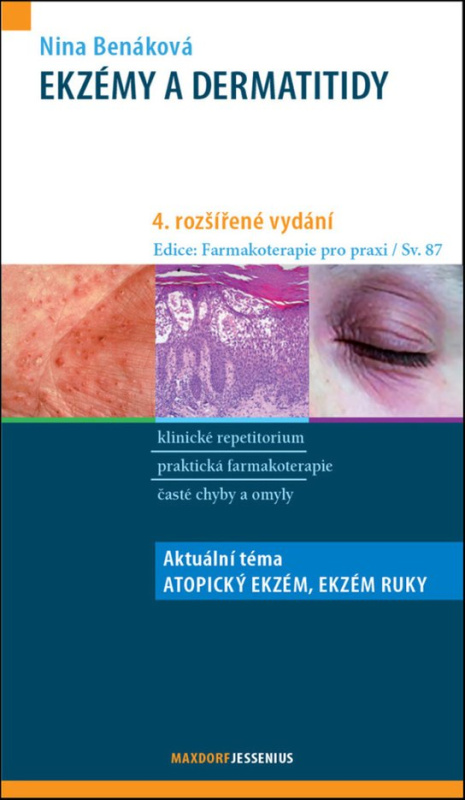 Ekzémy a dermatitidy - Nina Benáková