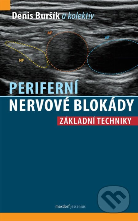 Periferní nervové blokády
