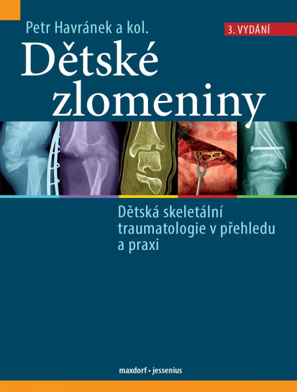 Dětské zlomeniny -  Petr Havránek
