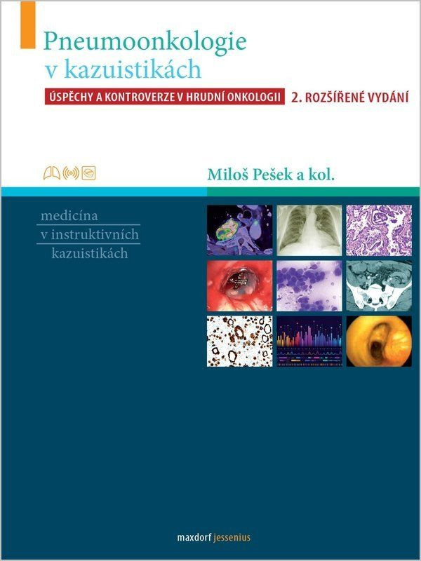 Pneumoonkologie v kazuistikách - Úspěchy a kontroverze v hrudní chirurgii,Pneumoonkologie v kazuistikách - Úspěchy a kontroverze v hrudní chirurgii