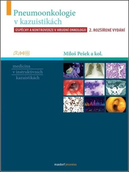 Pneumoonkologie v kazuistikách - Úspěchy a kontroverze v hrudní chirurgii,Pneumoonkologie v kazuistikách - Úspěchy a kontroverze v hrudní chirurgii