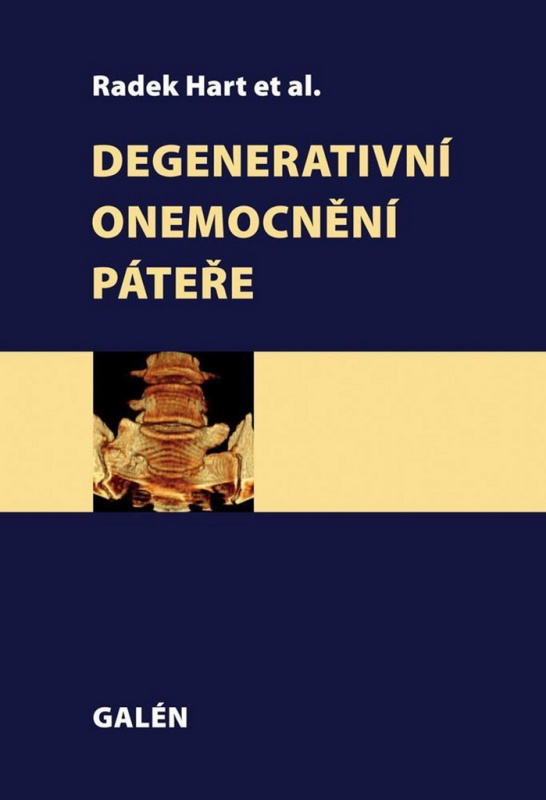 Degenerativní onemocnění páteře - Radek Hart, kol.