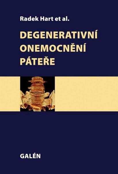 Degenerativní onemocnění páteře - Radek Hart, kol.