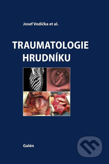 Traumatologie hrudníku - Josef Vodička, kol.
