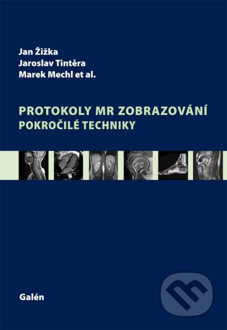 Protokoly MR zobrazování (Pokročilé techniky) - Jan Žižka, Jaroslav Tintěra, Marek Mechl - kniha z kategorie Neurochirurgie