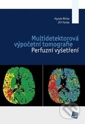 Multidetektorová výpočetní tomografie (Perfuzní vyšetření) - kniha z kategorie Medicína