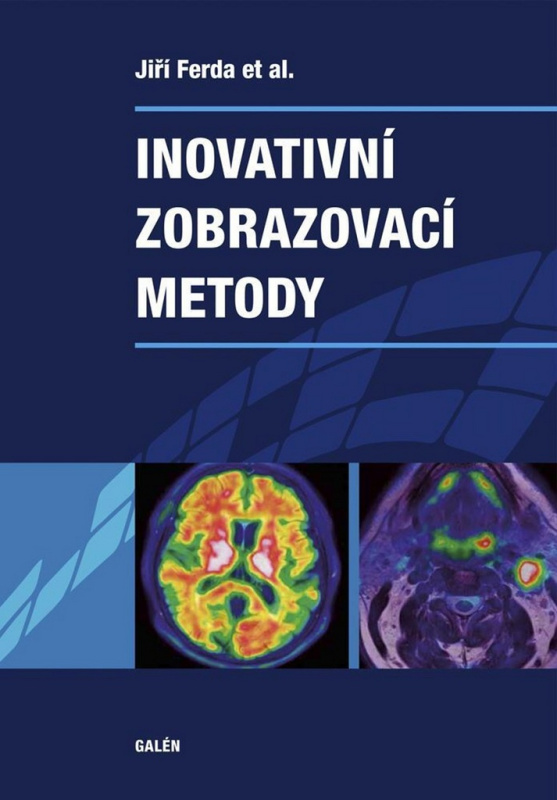 Inovativní zobrazovací metody - Jiří Ferda, kol.
