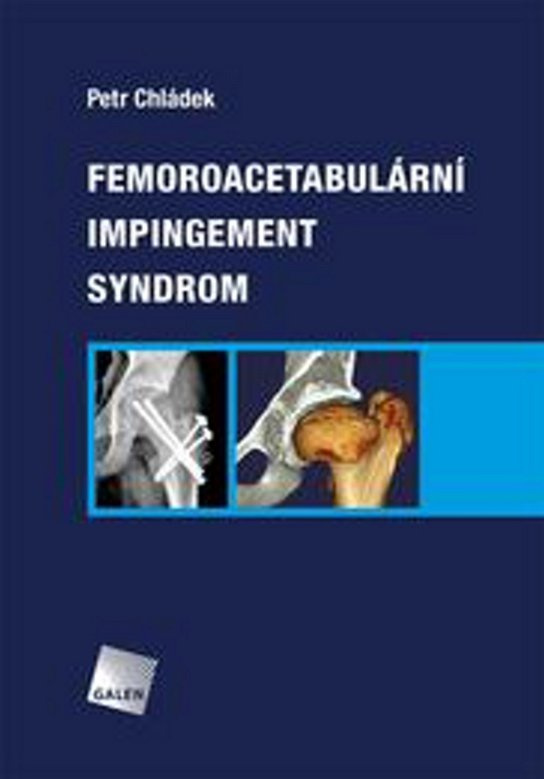 Femoroacetabulární impingement syndrom - Petr Chládek