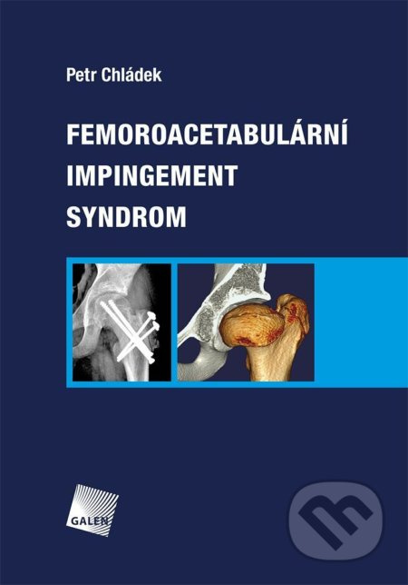 Femoroacetabulární impingement syndrom - Petr Chládek