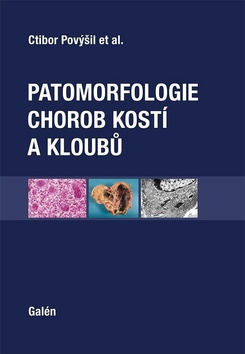 Patomorfologie chorob kostí a kloubů - Ivo Mařík, Alena Maříková, Martin Horák, Ctibor Povýšil