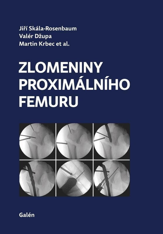Zlomeniny proximálního femuru - Jiří Skála-Rosenbaum, Valér Džupa, Martin Krbec - kniha z kategorie Úrazová chirurgie a ortopedie