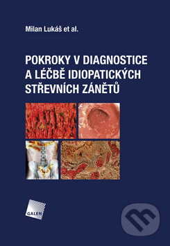 Pokroky v diagnostice a léčbě idiopatických střevních zánětů