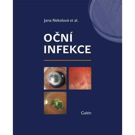 Oční infekce - Jana Nekolová