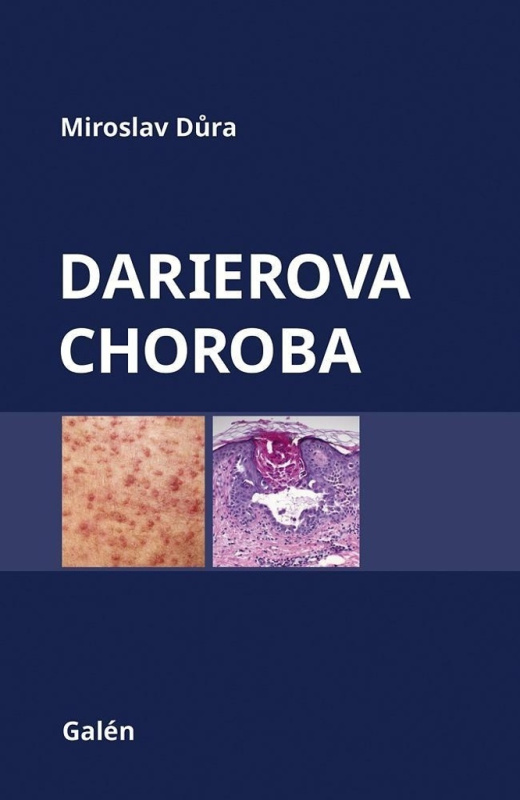 Darierova choroba - Miroslav Důra