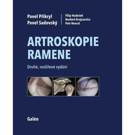 Artroskopie ramene - Pavel Sadovský, Pavel Přikryl, Filip Hudeček, Norbert Krajcsovics, Petr Neoral