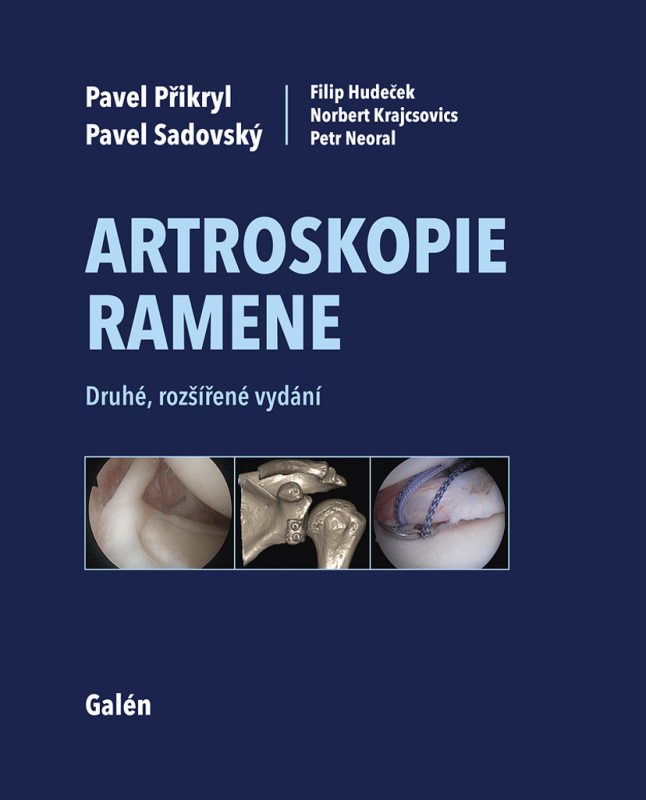 Artroskopie ramene - Pavel Sadovský, Pavel Přikryl, Filip Hudeček, Norbert Krajcsovics, Petr Neoral