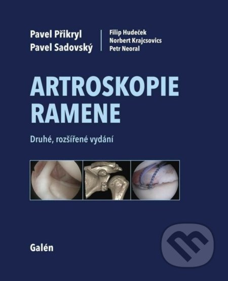Artroskopie ramene - Pavel Sadovský, Pavel Přikryl, Filip Hudeček, Norbert Krajcsovics, Petr Neoral