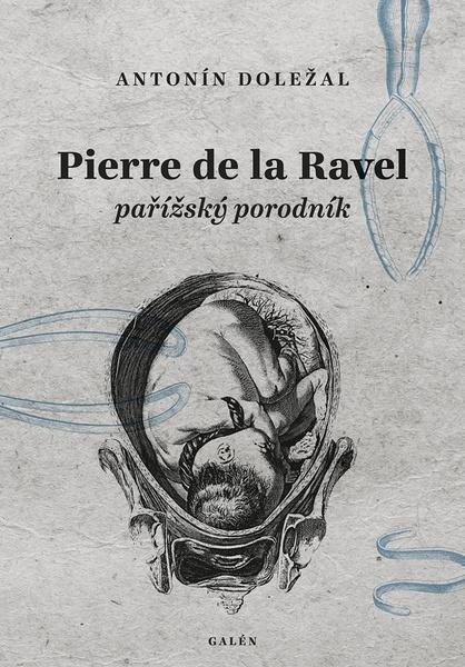 Pierre de la Ravel, pařížský porodník - Antonín Doležal
