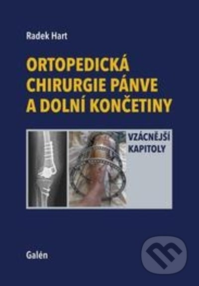 Ortopedická chirurgie pánve a dolních končetin - Radek Hart