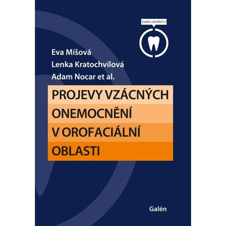 Projevy vzácných onemocnění v orofaciální oblasti - Eva Míšová, Lenka Kratochvílová, Adam Nocar