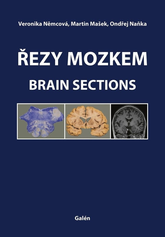 Řezy mozkem / Brain Sections