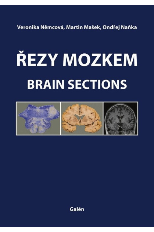 Řezy mozkem / Brain Sections
