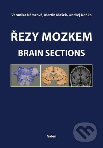 Řezy mozkem / Brain Sections
