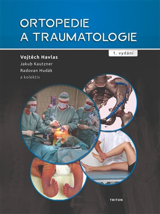 Ortopedie a traumatologie