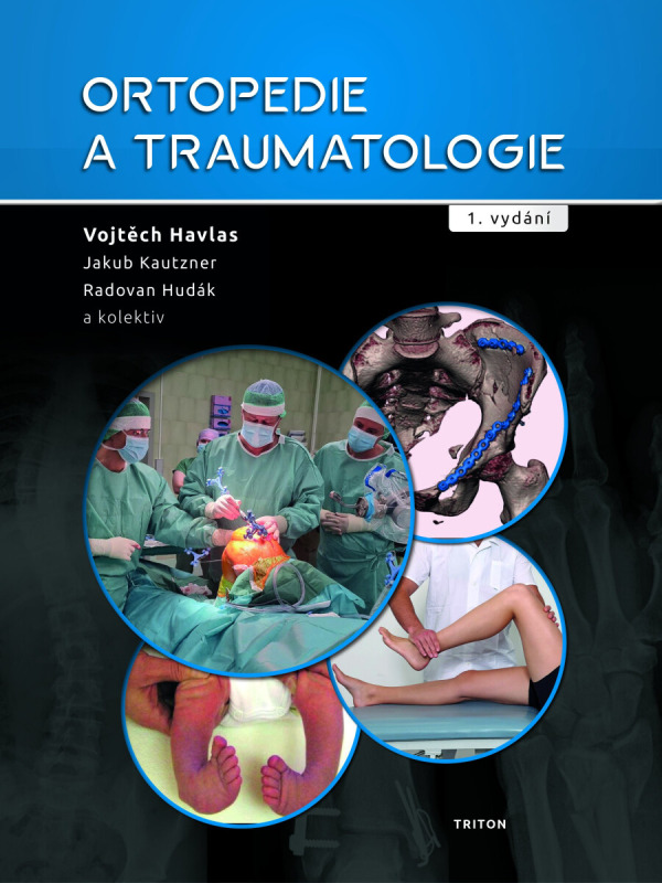 Ortopedie a traumatologie