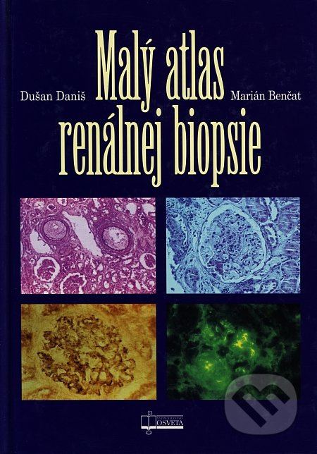 Malý atlas renálnej biopsie - Dušan Daniš, Marián Benčat - kniha z kategorie Nefrologie a gastroenterologie
