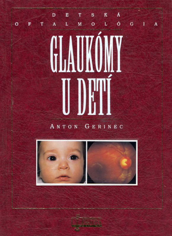 Glaukómy u detí - Anton Gerinec - kniha z kategorie Pediatrie