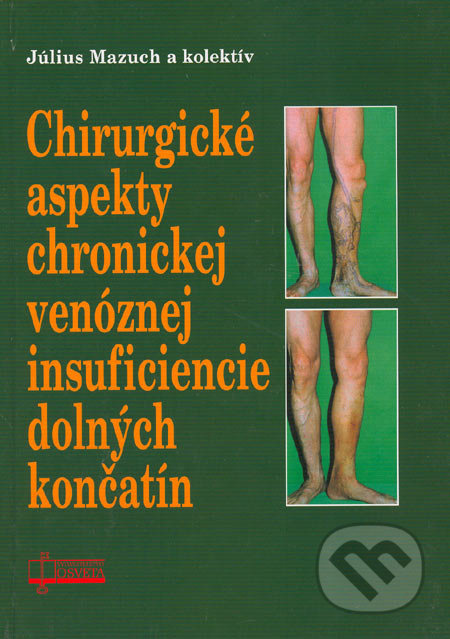 Chirurgické aspekty chronickej venóznej insuficiencie dolných končatín - kniha z kategorie Kardiovaskulární chirurgie