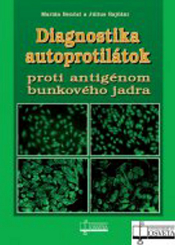 Diagnostika autoprotilátok (Proti antigénom bunkového jadra) - kniha z kategorie Imunologie, virologie a epidemiologie