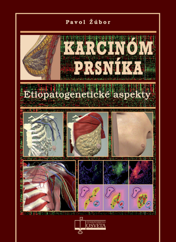 Karcinóm prsníka (Etiopatogenetické aspekty) - Pavol Žúbor - kniha z kategorie Gynekologie