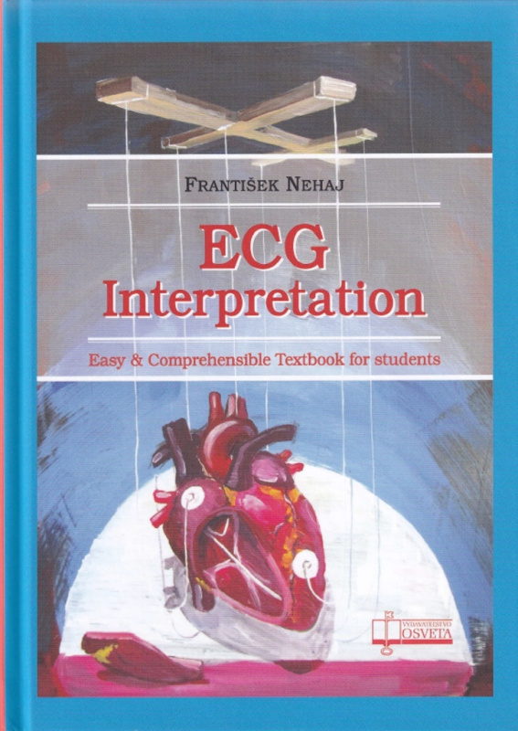 ECG Interpretation (Easy Comprehensible Textbook for students) - kniha z kategorie Medicína