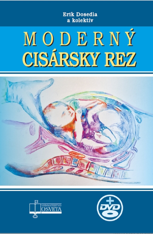 Moderný cisársky rez (+ CD) - Erik Dosedla, kolektív autorov - kniha z kategorie Gynekologie
