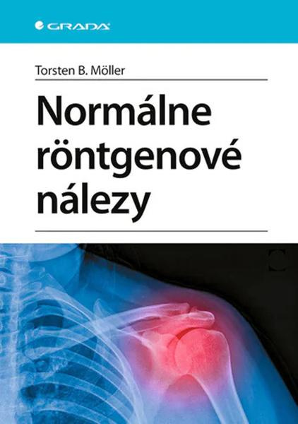Normálne röntgenové nálezy (Vedieť, čo je normálne. Znalosť normality ako podmienky pre rozpoznanie patologických zmien.),Normálne röntgenové nálezy (