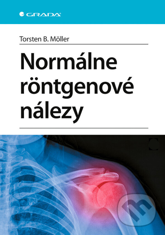 Normálne röntgenové nálezy (Vedieť, čo je normálne. Znalosť normality ako podmienky pre rozpoznanie patologických zmien.),Normálne röntgenové nálezy (