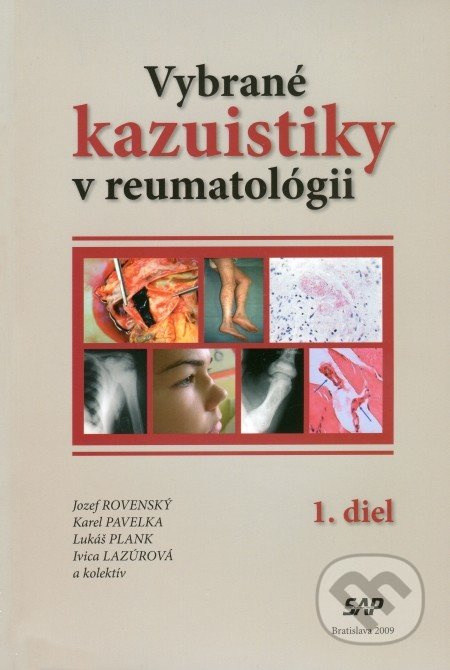 Vybrané kazuistiky v reumatológii (1+2 diel) - Jozef Rovenský, Karel Pavelka, Lukáš Plank, Ivica Lazúrová - kniha z kategorie Revmatologie