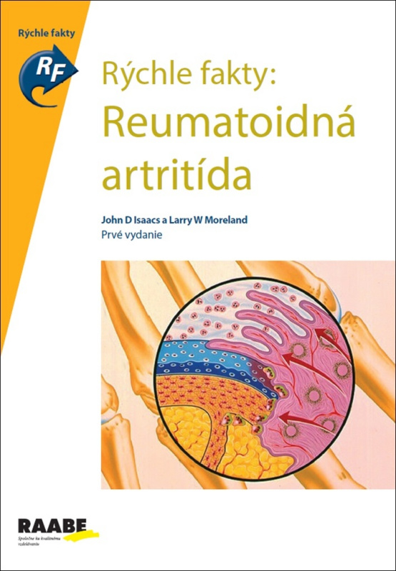 Reumatoidná artritída (Rýchle fakty) - John D. Isaacs, Larry W. Moreland - kniha z kategorie Revmatologie