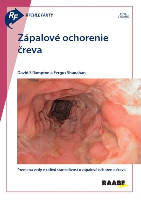 Rýchle fakty: Zápalové ochorenie čreva  - David S Rampton, Fergus Shanahan - kniha z kategorie Medicína