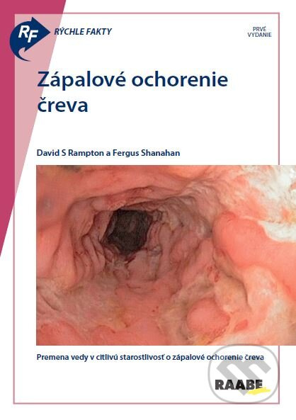 Rýchle fakty: Zápalové ochorenie čreva  - David S Rampton, Fergus Shanahan - kniha z kategorie Medicína