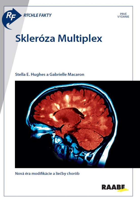 Rýchle fakty: Skleróza multiplex - kniha z kategorie Medicína