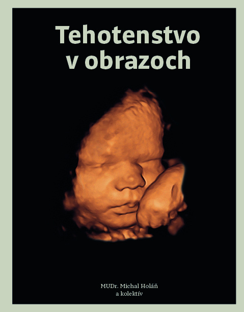 Tehotenstvo v obrazoch - Michal Holáň a kolektív - kniha z kategorie Vztahy a rodina
