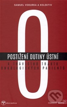 Postižení dutiny ústní a trávicího traktu onkologických pacientů - Samuel Vokurka, kol.