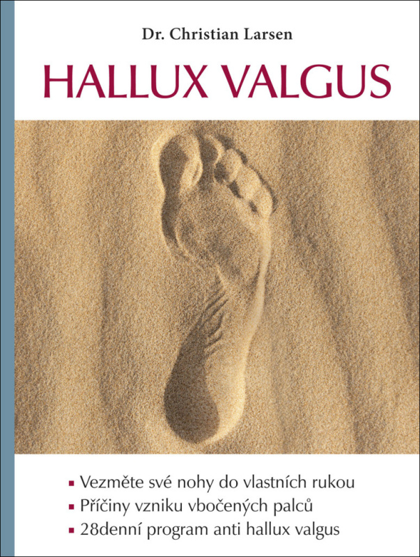 Hallux valgus - Christian Larsen