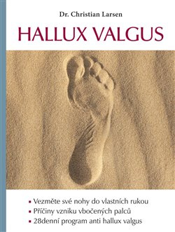 Hallux valgus - Christian Larsen